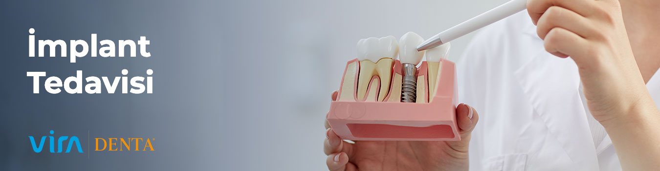 umraniye implant tedavisi